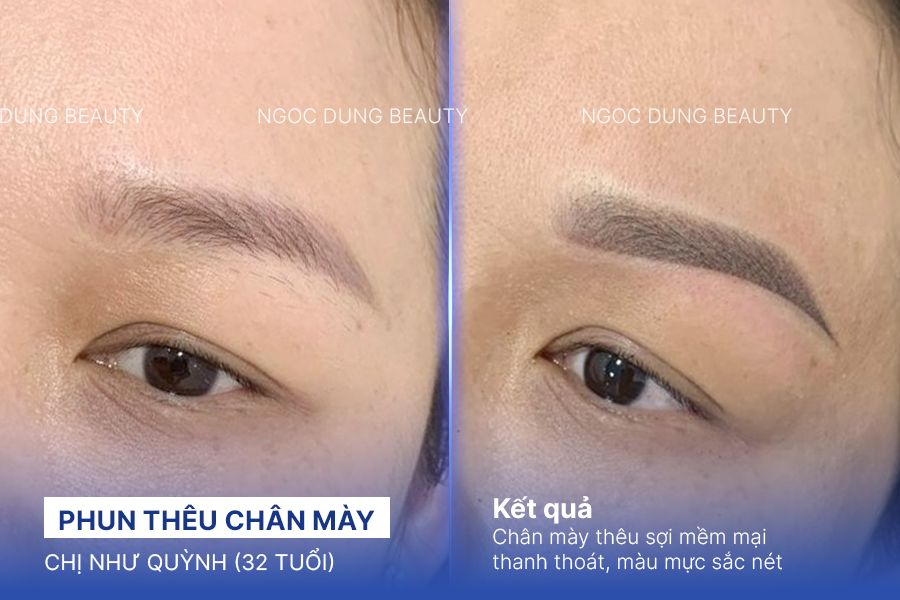 Chị Như Quỳnh (32 tuổi) - Phun Thêu Chân Mày