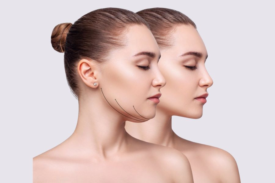 Chườm lạnh sau hút mỡ mặt sẽ giúp giảm sưng đau