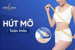 hút mỡ toàn thân