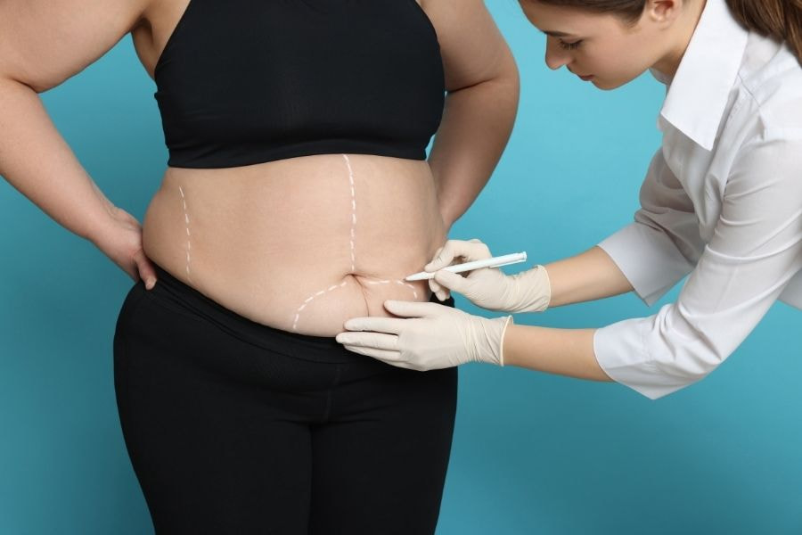 Bác sĩ sẽ tiến hành khám tổng quan để đánh giá bạn có thể hút mỡ bụng hay không