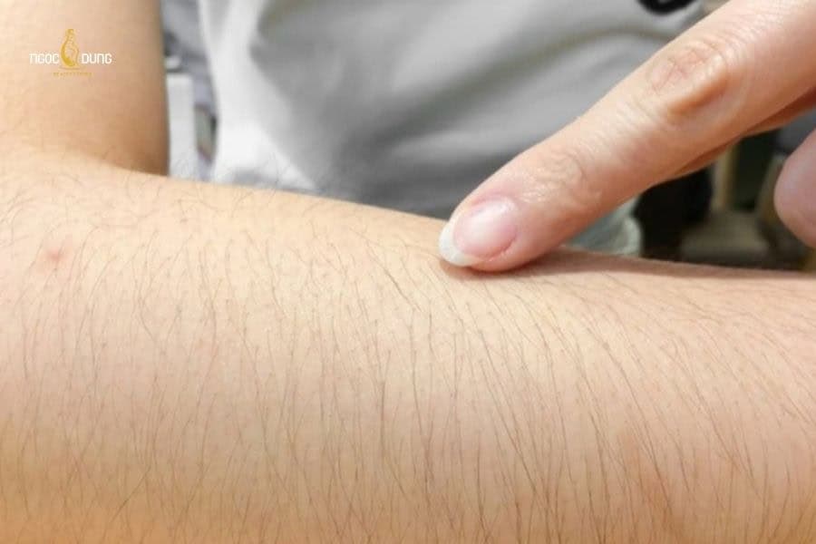 Dù không phải cơ chế bảo vệ chính, nhưng lông tay vẫn góp phần duy trì trạng thái ổn định của da