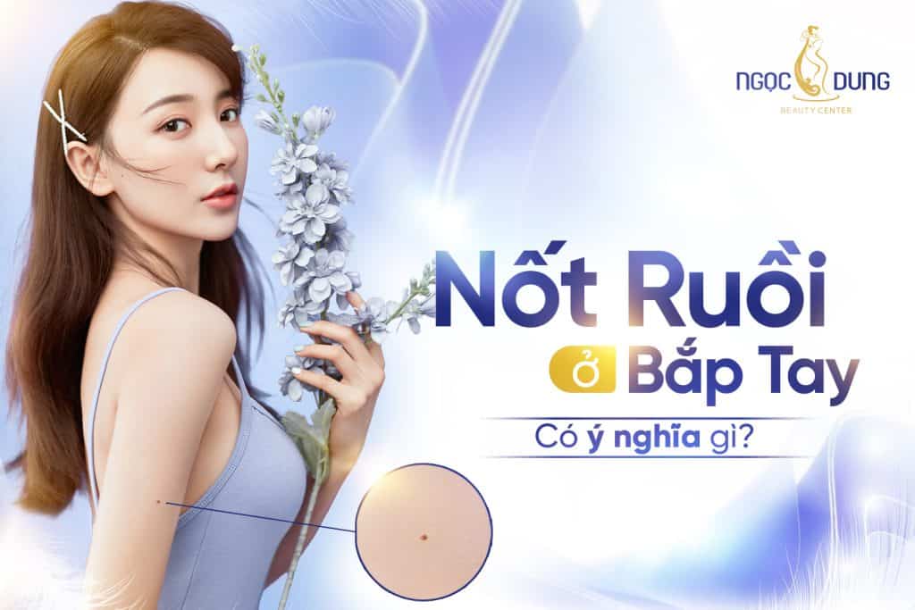 Nốt ruồi ở bắp tay: Giải mã ý nghĩa và lưu ý cần biết