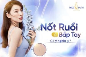Nốt ruồi ở bắp tay: Giải mã ý nghĩa và lưu ý cần biết