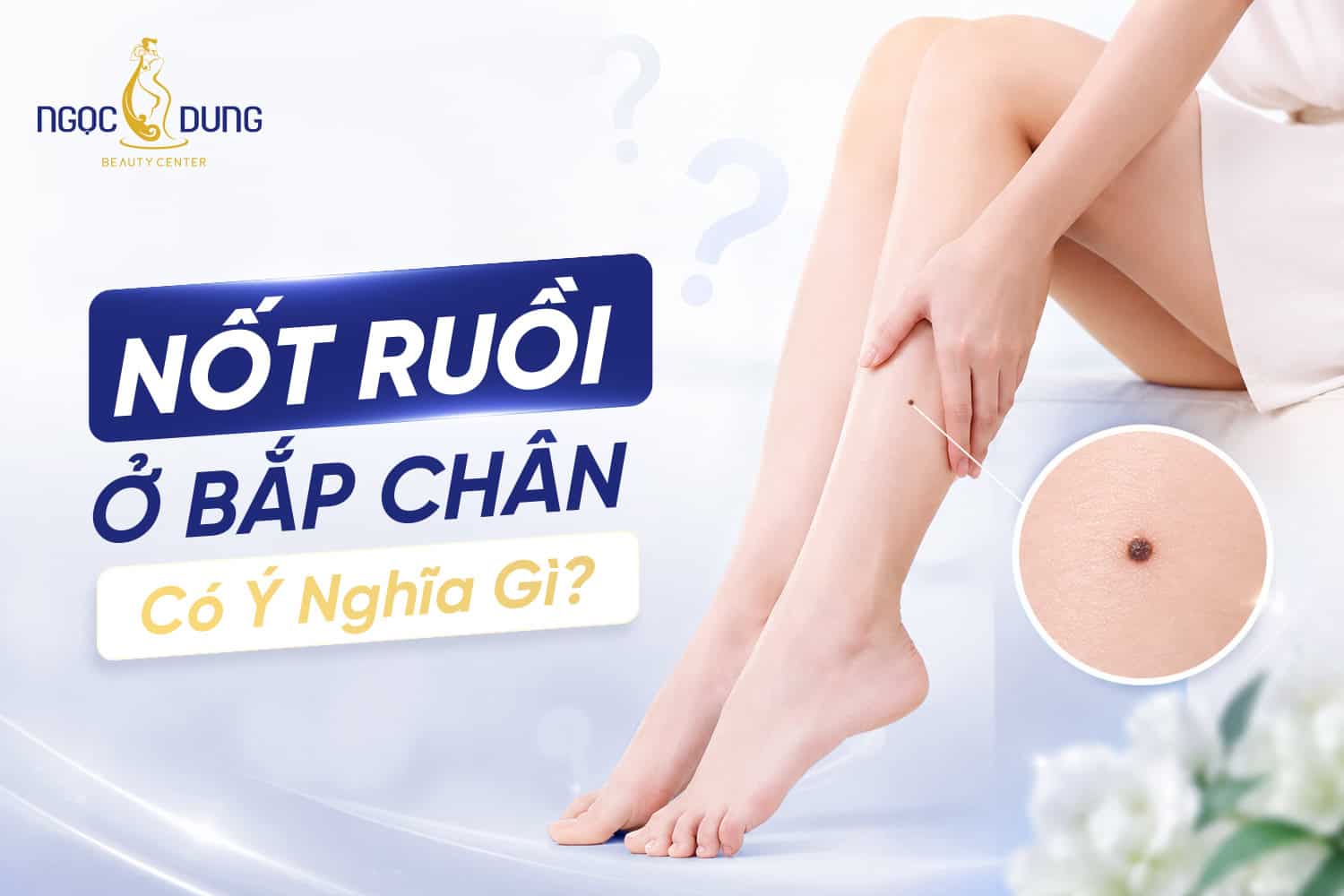 Nốt ruồi ở bắp chân có an toàn không? Khi nào cần xóa?