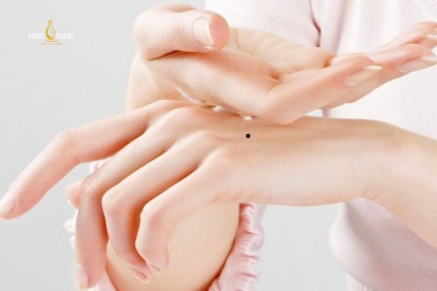 Nốt ruồi ở bàn tay có ý nghĩa gì theo nhân tướng học? 3 Cần theo dõi những nốt ruồi tự mọc ở tay thường xuyên để kịp thời xử lý biến chứng nếu có
