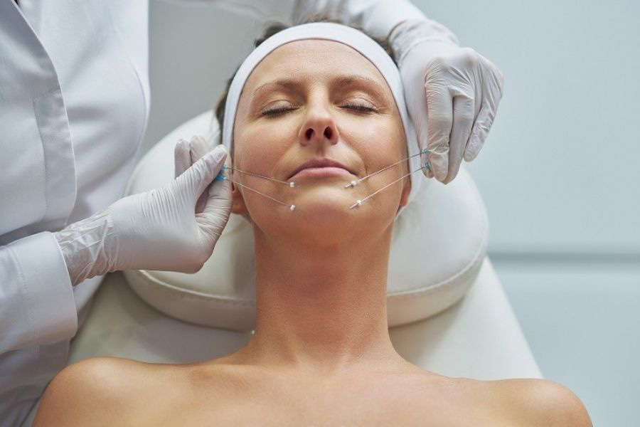 Kết quả căng chỉ da mặt phụ thuộc rất lớn vào tay nghề bác sĩ và chất lượng chỉ sử dụng