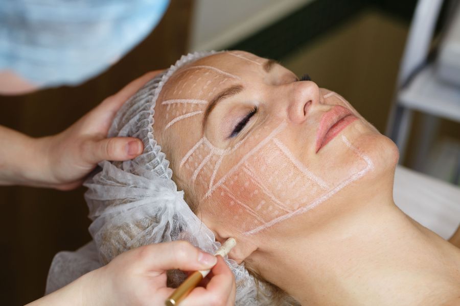 Kỹ thuật Contour được ứng dụng trong điêu khắc trẻ hóa 10 đường line mặt