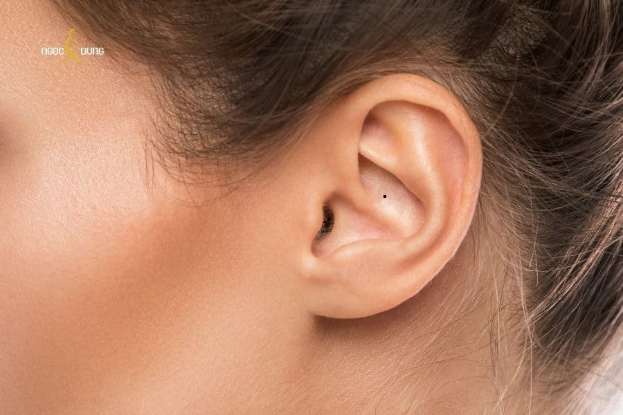 Nốt ruồi bên trong lỗ tai thường mang ý nghĩa tích cực về sức khỏe và tình duyên