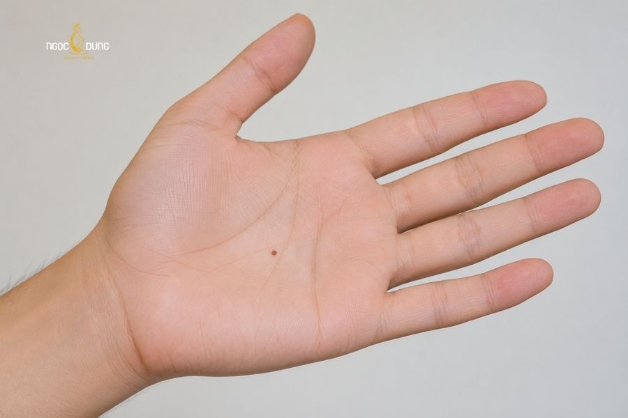 Giải mã ý nghĩa nốt ruồi ở lòng bàn tay nam nữ chi tiết 3 Nam giới sở hữu nốt ruồi ở lòng bàn tay phải thường có sự nghiệp khởi sắc sau 25 tuổi