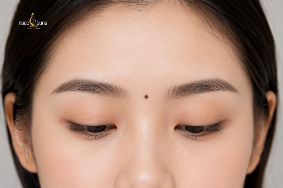 Người có nốt ruồi ở ấn đường thường gặp vạn may trong sự nghiệp