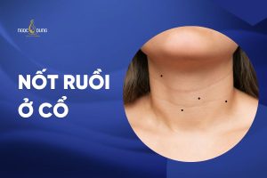 nốt ruồi ở cổ