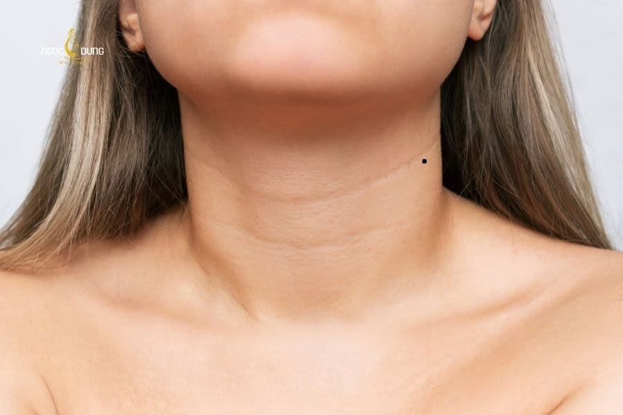 Nốt ruồi ở cổ phải nữ và nam đều mang ý nghĩa tinh thần năng động, vui tươi