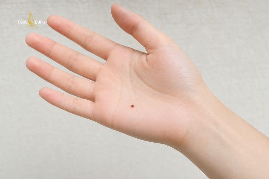 Giải mã ý nghĩa nốt ruồi ở lòng bàn tay nam nữ chi tiết 2 Phụ nữ có nốt ruồi ở lòng bàn tay trái thường có cuộc sống êm đềm