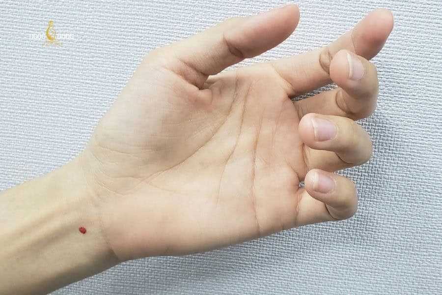 Nốt ruồi ở bàn tay có ý nghĩa gì theo nhân tướng học? 4 Nốt ruồi son ở bàn tay thường mang lại ý nghĩa may mắn trong cuộc sống cho người sở hữu