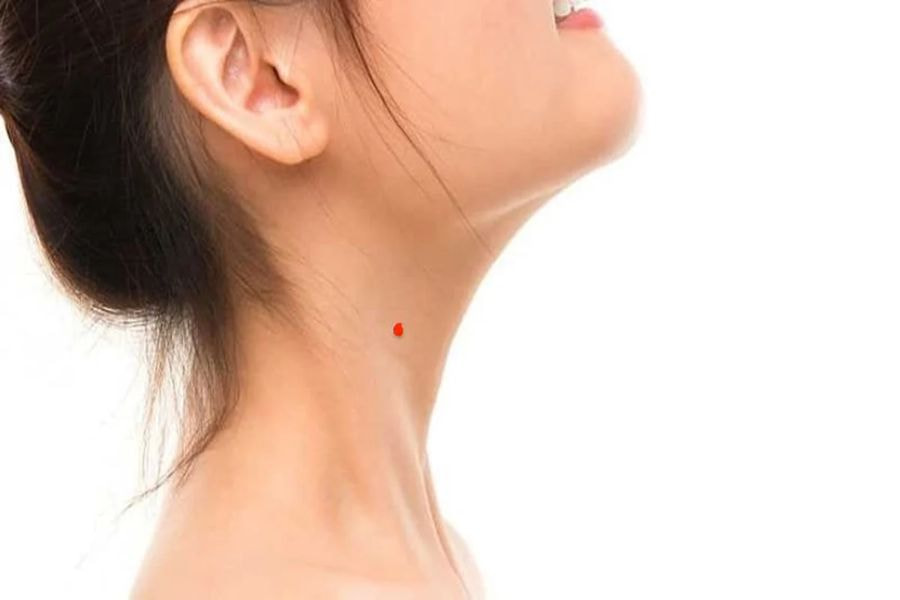 Người có nốt ruồi son ở cổ thường gặp nhiều may mắn trong cuộc sống