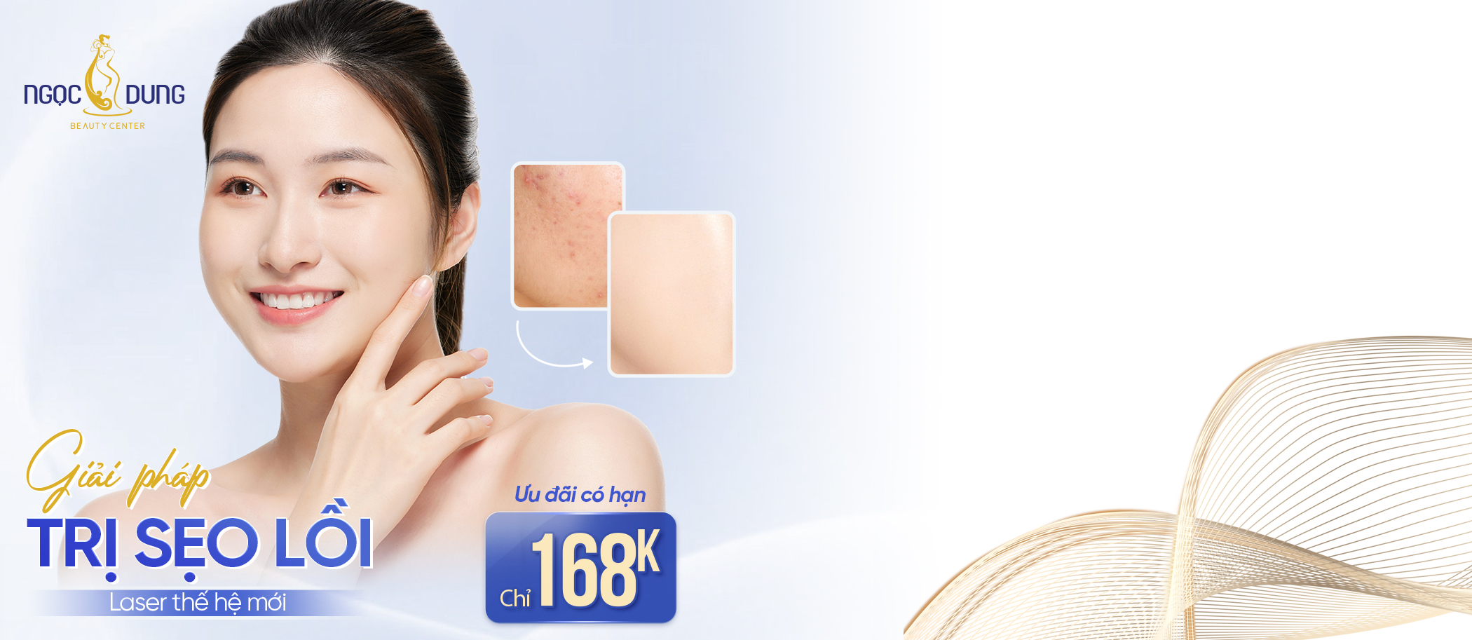 ưu đãi trị sẹo lồi