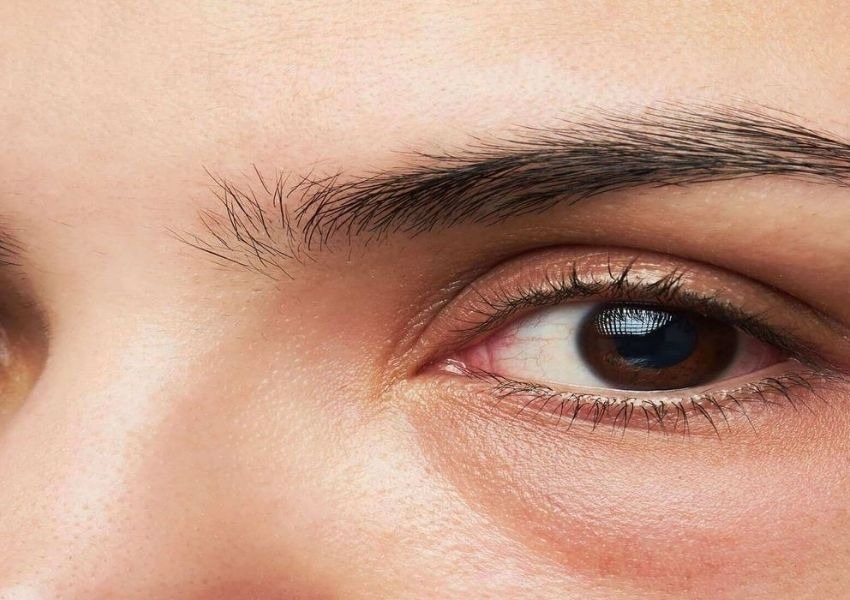 Bọng mắt khiến gương mặt kém sắc hơn