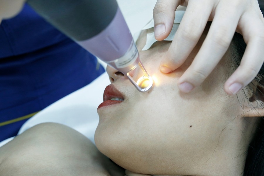 Laser trị thâm mụn tại Thẩm mỹ viện Ngọc Dung được thực hiện bởi chuyên viên có tay nghề cao