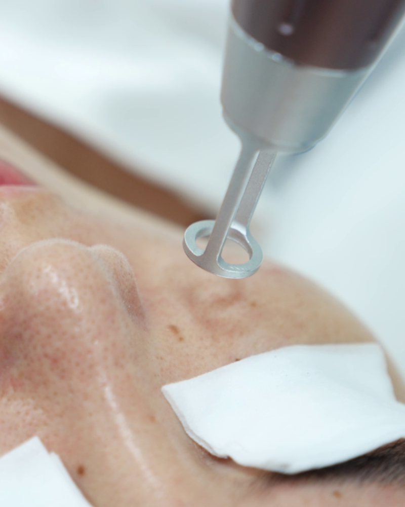 di tia tri seo lom 1