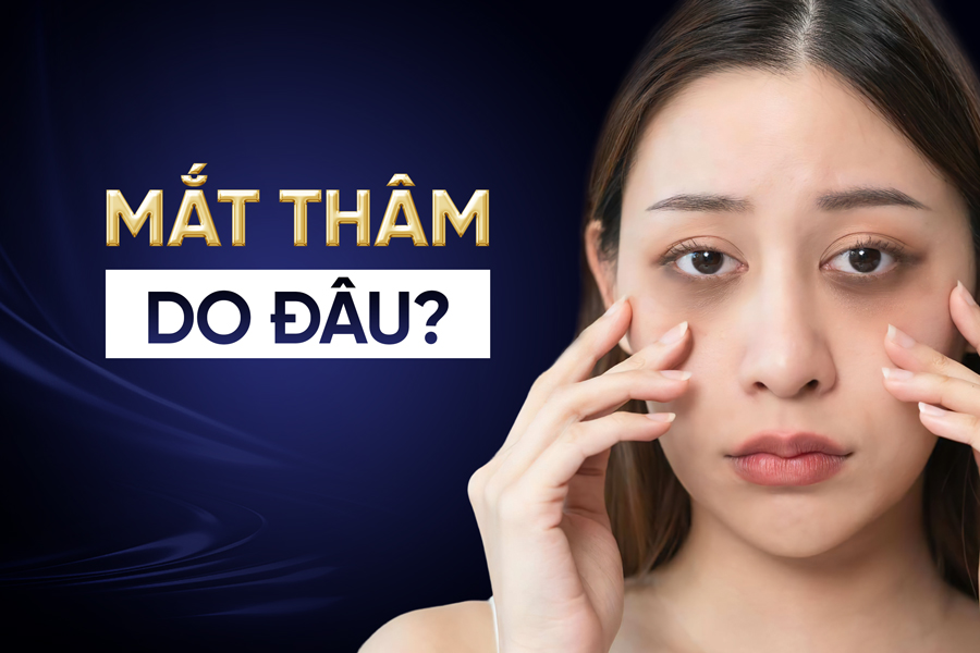 nguyen nhan mat tham