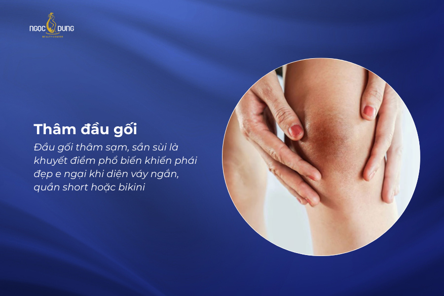 tham dau goi la gi 1