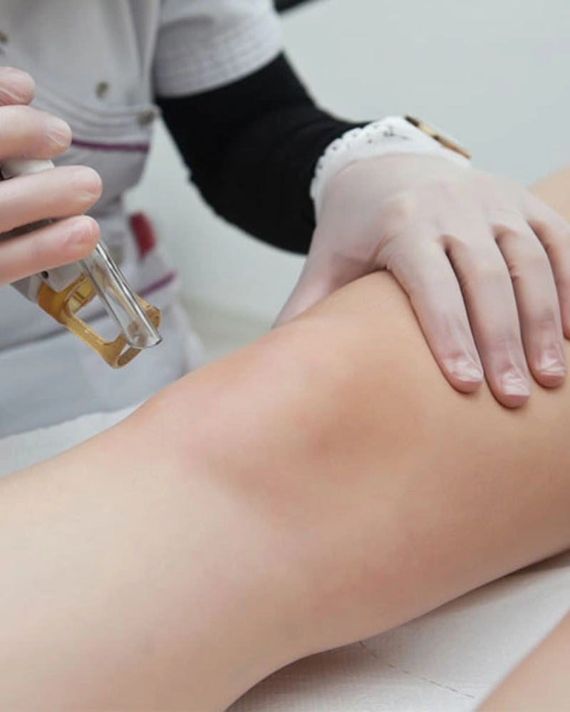 tien hanh tri tham dau goi