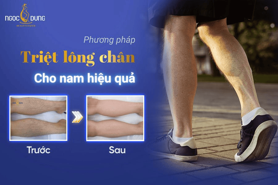 Triệt lông chân nam có hiệu quả không? Các phương pháp nên biết 2 Triệt lông chân nam có hiệu quả không?