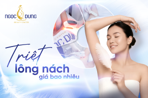 Giá Triệt Lông Nách Bao Nhiêu? Bảng Giá & Chi Phí Liệu Trình Mới Nhất