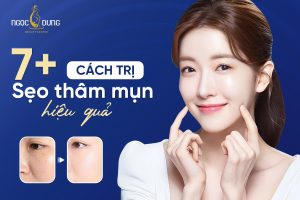 7 cách trị sẹo thâm mụn hiệu quả nhất hiện nay