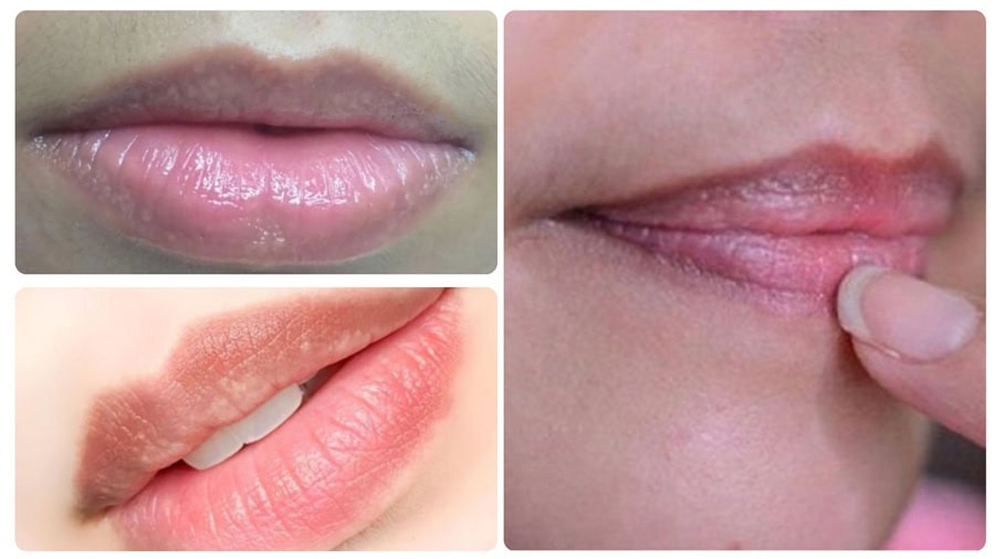 Mực đã ăn sâu vào da khó có thể xóa xăm tại nhà