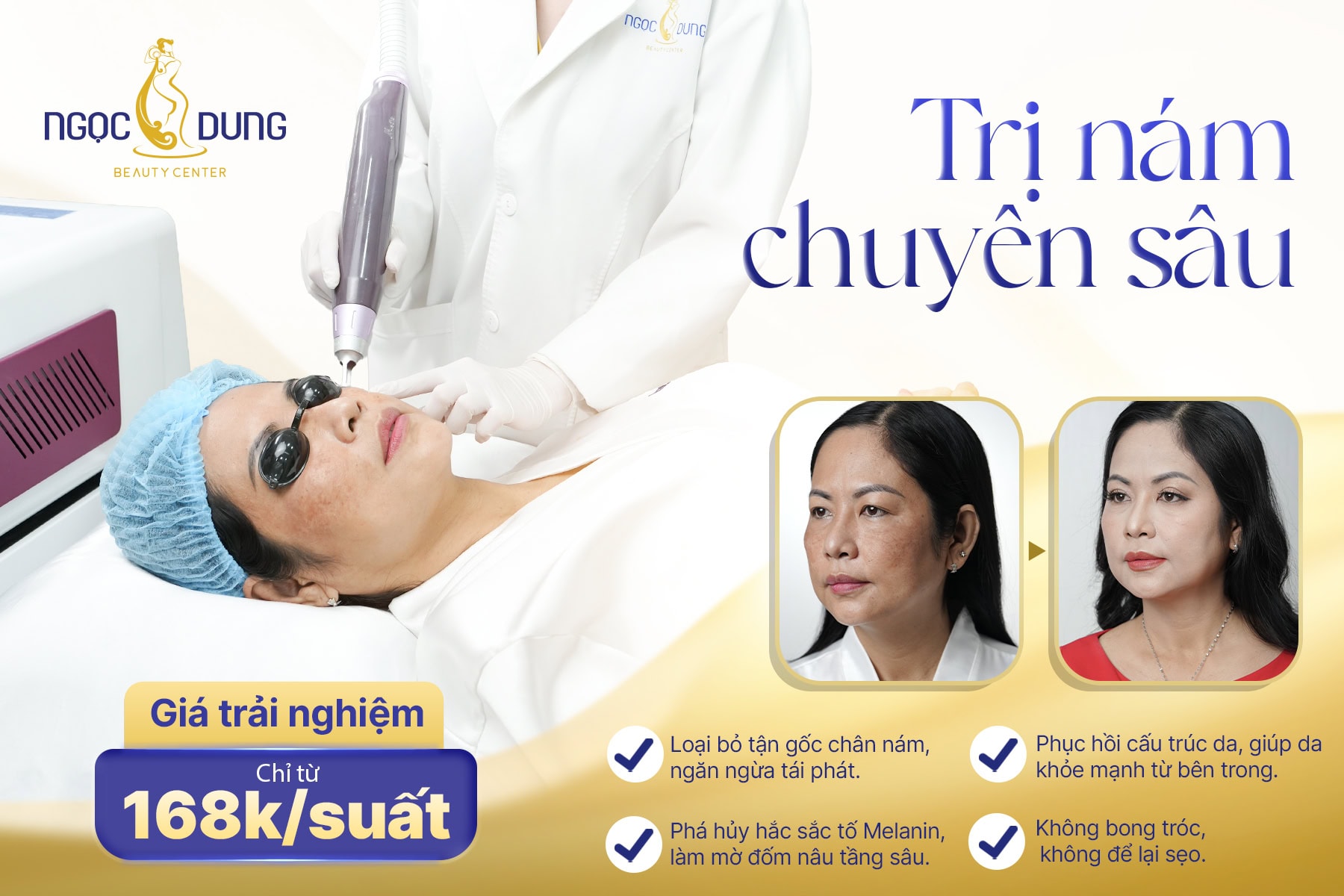 Trị nám theo cơ chế kiểm soát melanin và tái tạo da chuyên sâu