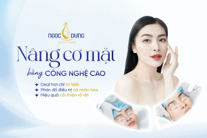 T1 BANNER WEB NANG CO MAT