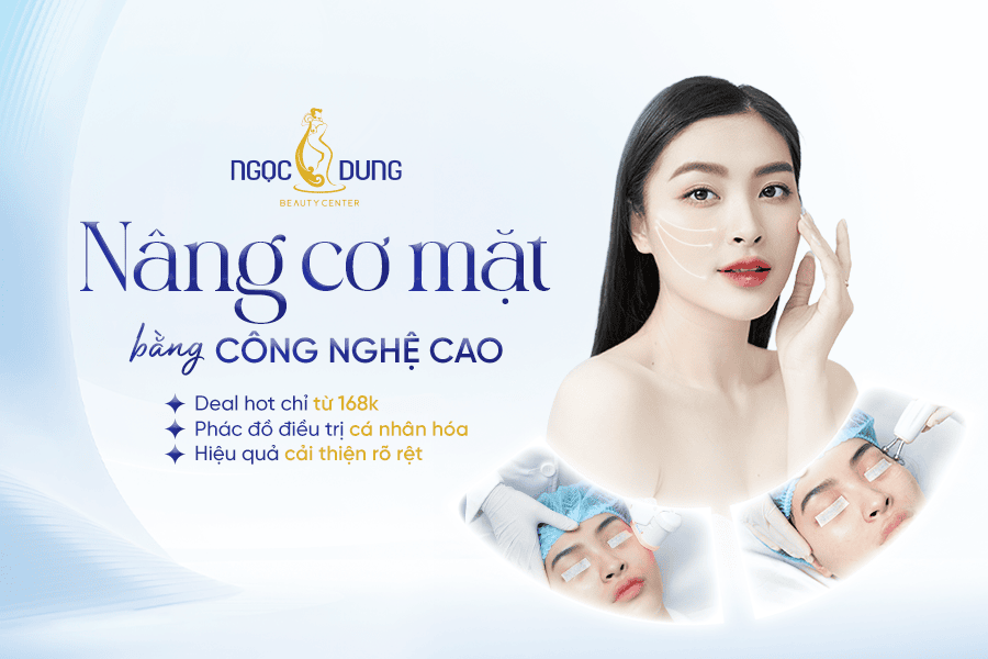 T1 BANNER WEB NANG CO MAT