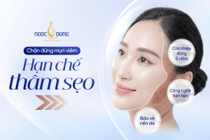 Trị mụn viêm từ gốc viêm nhiễm cá nhân hóa liệu trình