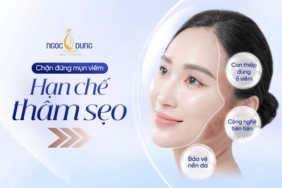 Trị mụn viêm từ gốc viêm nhiễm cá nhân hóa liệu trình