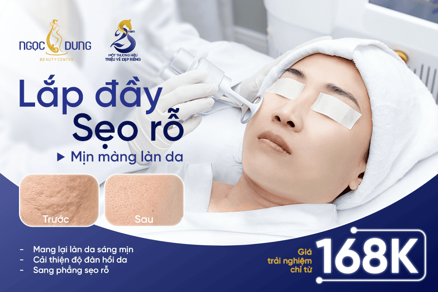 Trị sẹo rỗ nhanh chóng: Phương pháp hiện đại dành cho bạn