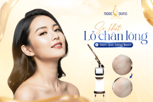 T1 SEO Sekhitlochanlongbanglaser