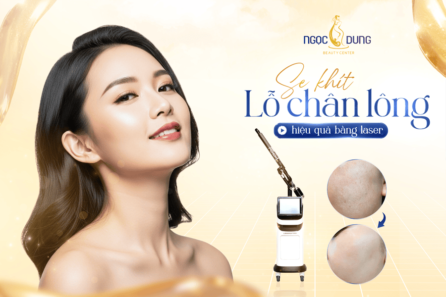 T1 SEO Sekhitlochanlongbanglaser