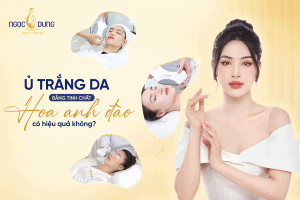 T1 SEO U trang bang tinh chat hoa anh dao