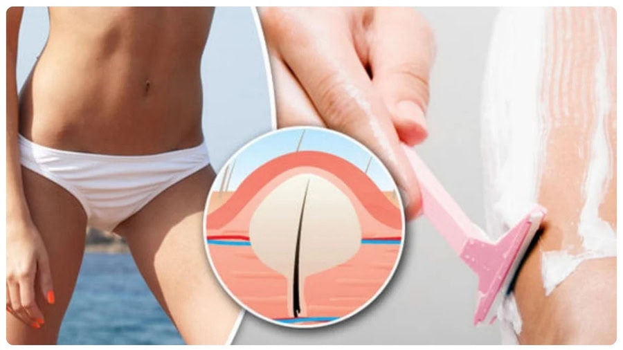 Wax bikini sẽ khiến lông mọc chậm hơn