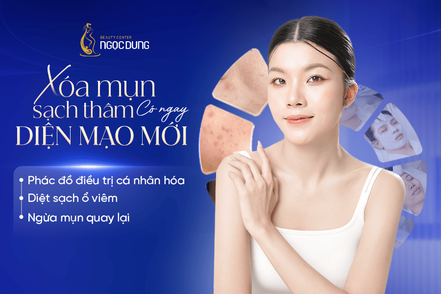Điều trị da đa vùng cho làn da sáng mịn từ mặt đến body 25 Trị mụn không tái phát với liệu trình công nghệ cao