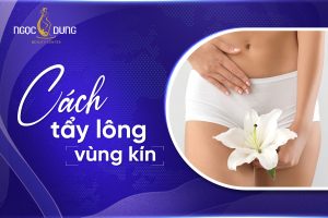 cách tẩy lông vùng kín