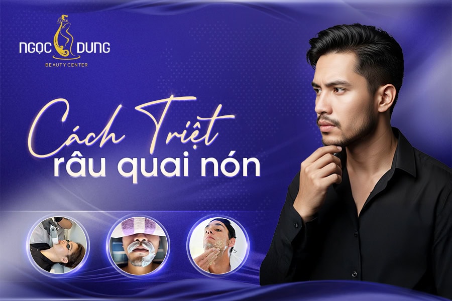 cách triệt râu quai nón