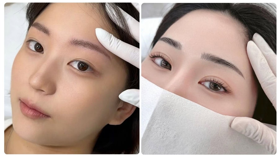 Có thể làm mờ màu xăm tại nhà nếu áp dụng đúng cách