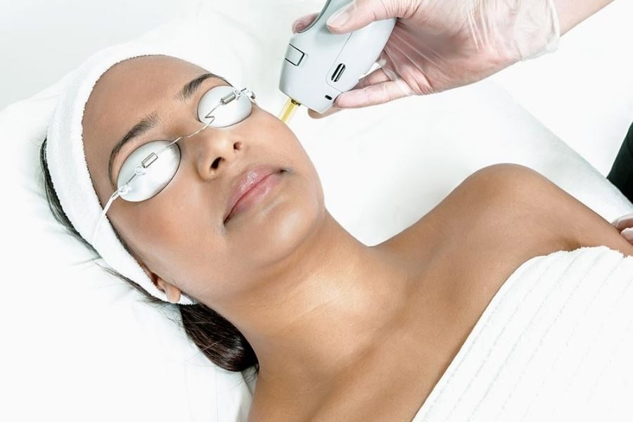 Laser Alexandrite giảm nguy cơ tác dụng phụ so với thế hệ cũ