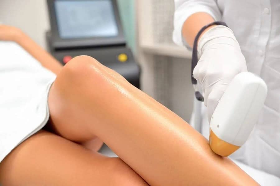 Triệt lông bằng tia Laser thường không gây đau rát