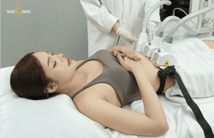 Điều trị rạn da bằng công nghệ cao tại TMV Ngọc Dung