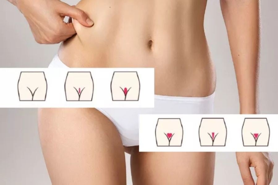 Tình trạng lông và nhu cầu của mỗi người cũng tác động tới mức giá