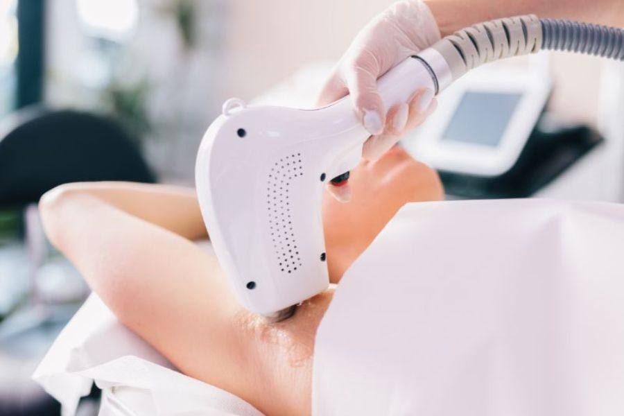 Giá triệt lông nách bao nhiêu? Bảng giá & chi phí mới nhất 3 Mức giá triệt lông nách phụ thuộc nhiều yếu tố