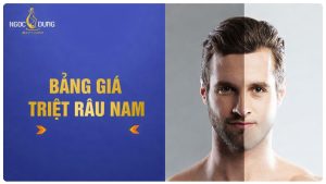 Giá triệt râu: Bảng giá, yếu tố ảnh hưởng và cách so sánh